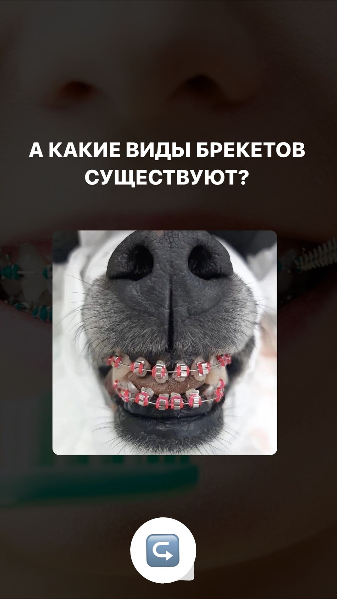 Брекеты кейс