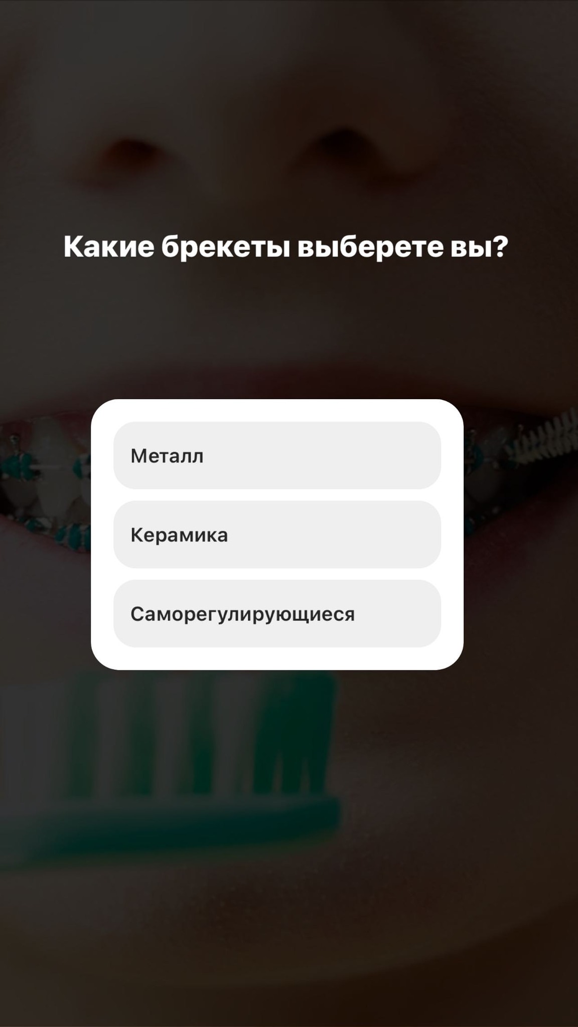 Брекеты ортодонтия