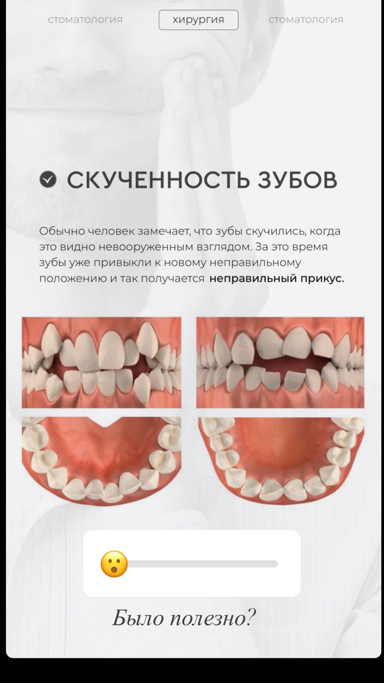 Хирургия результат