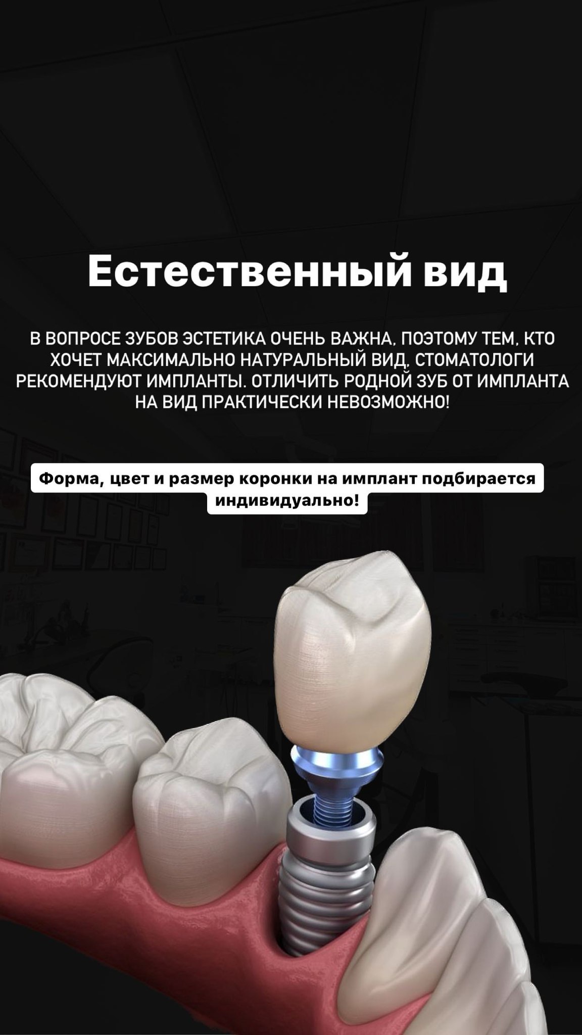 Имплантация