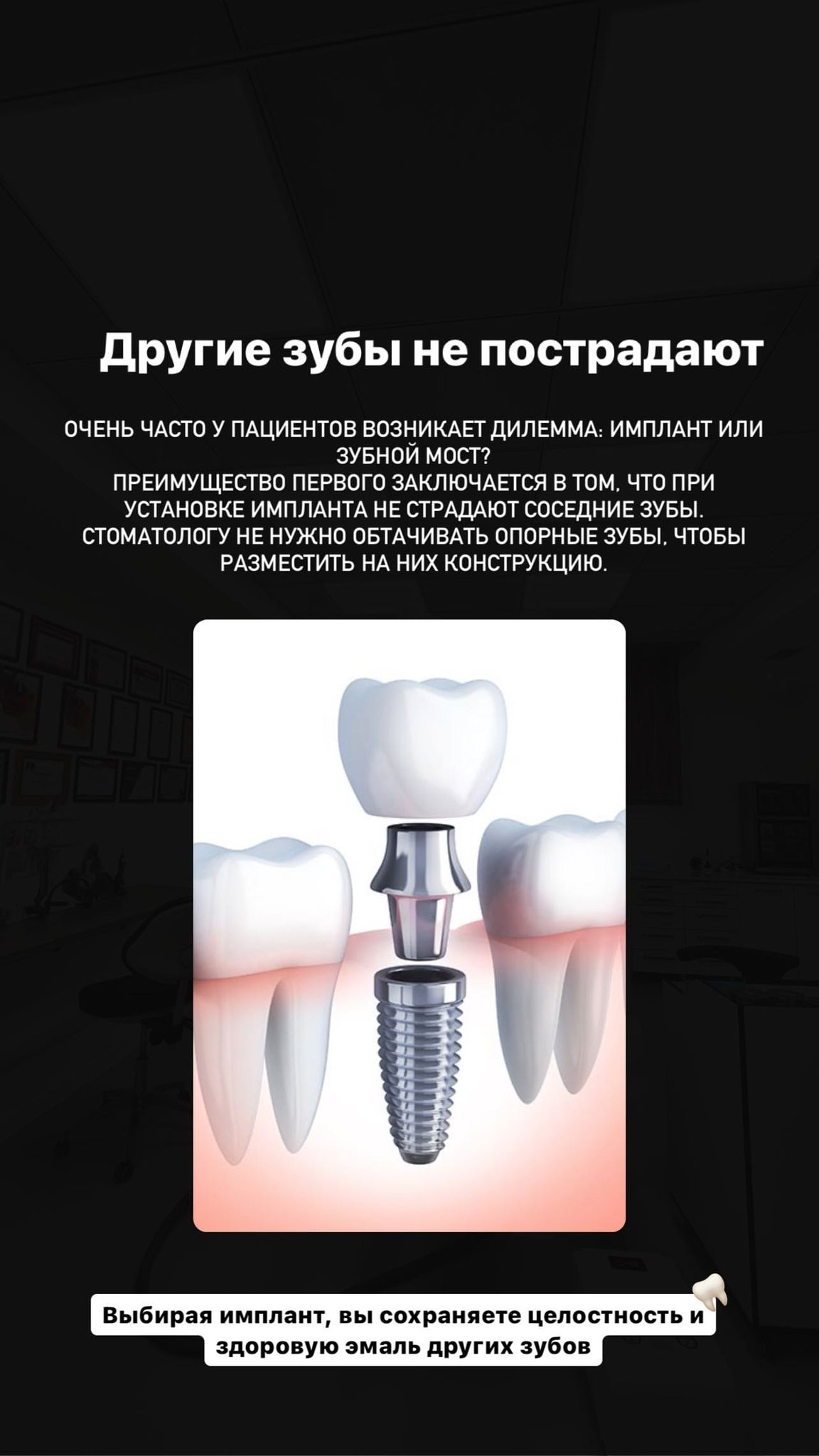 Имплантация