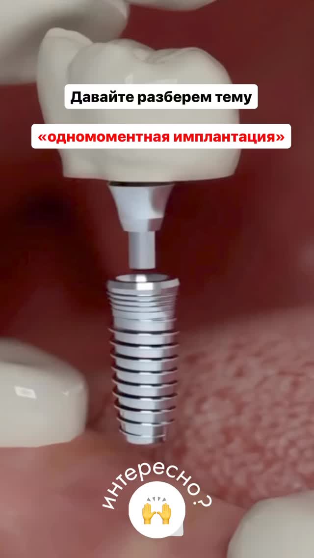 Имплантация результат Osh