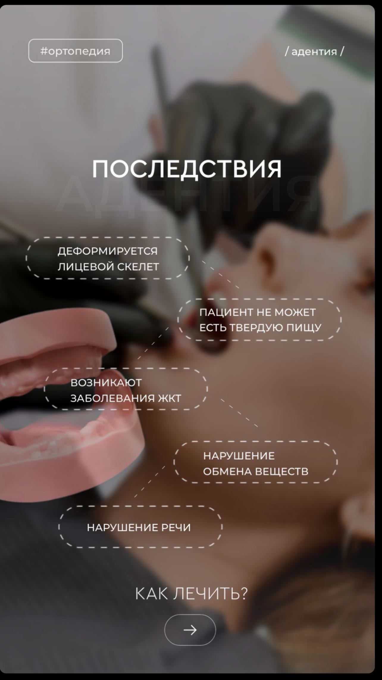 Протезирование кейс