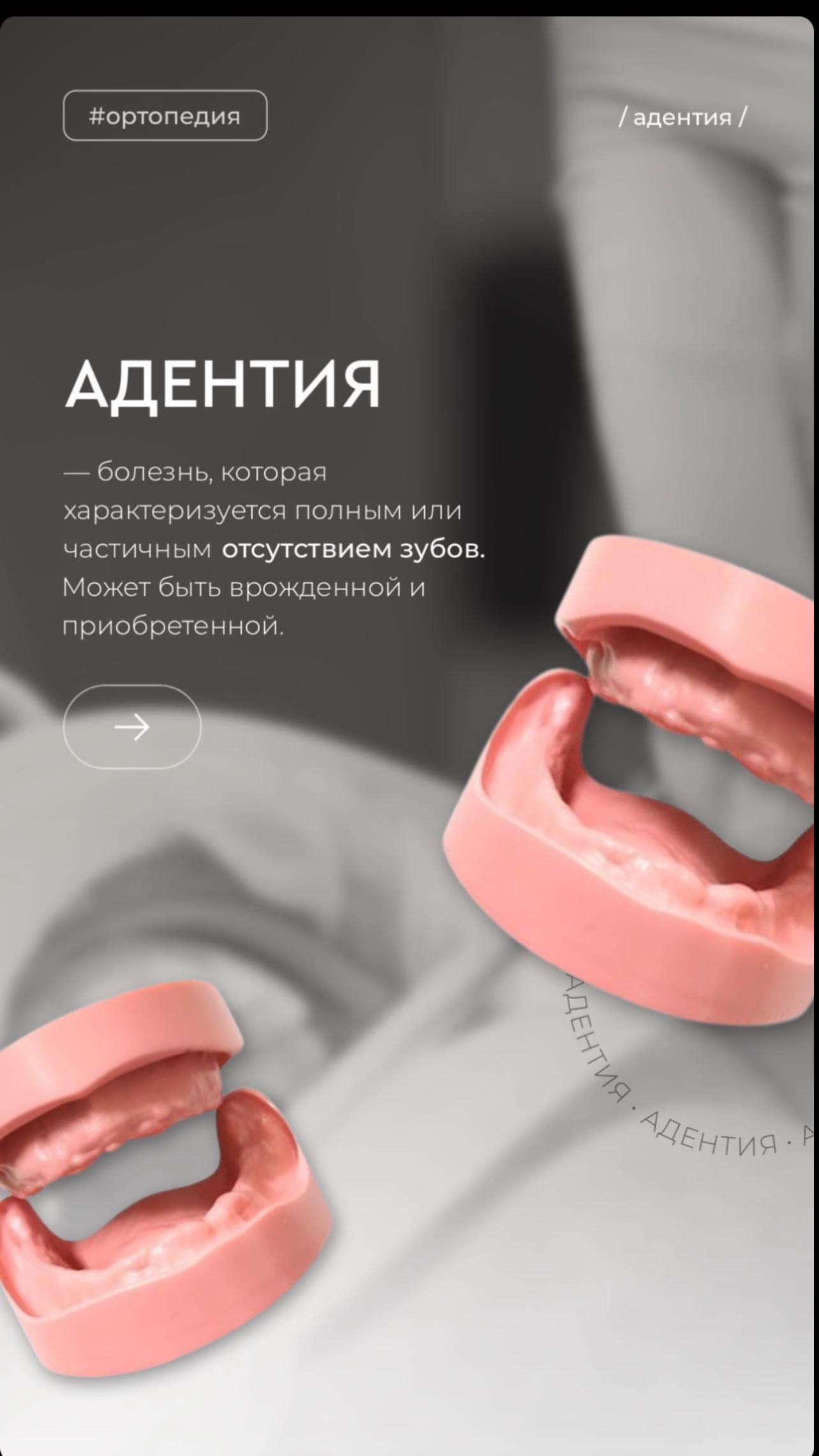 Восстановление зубов Ош