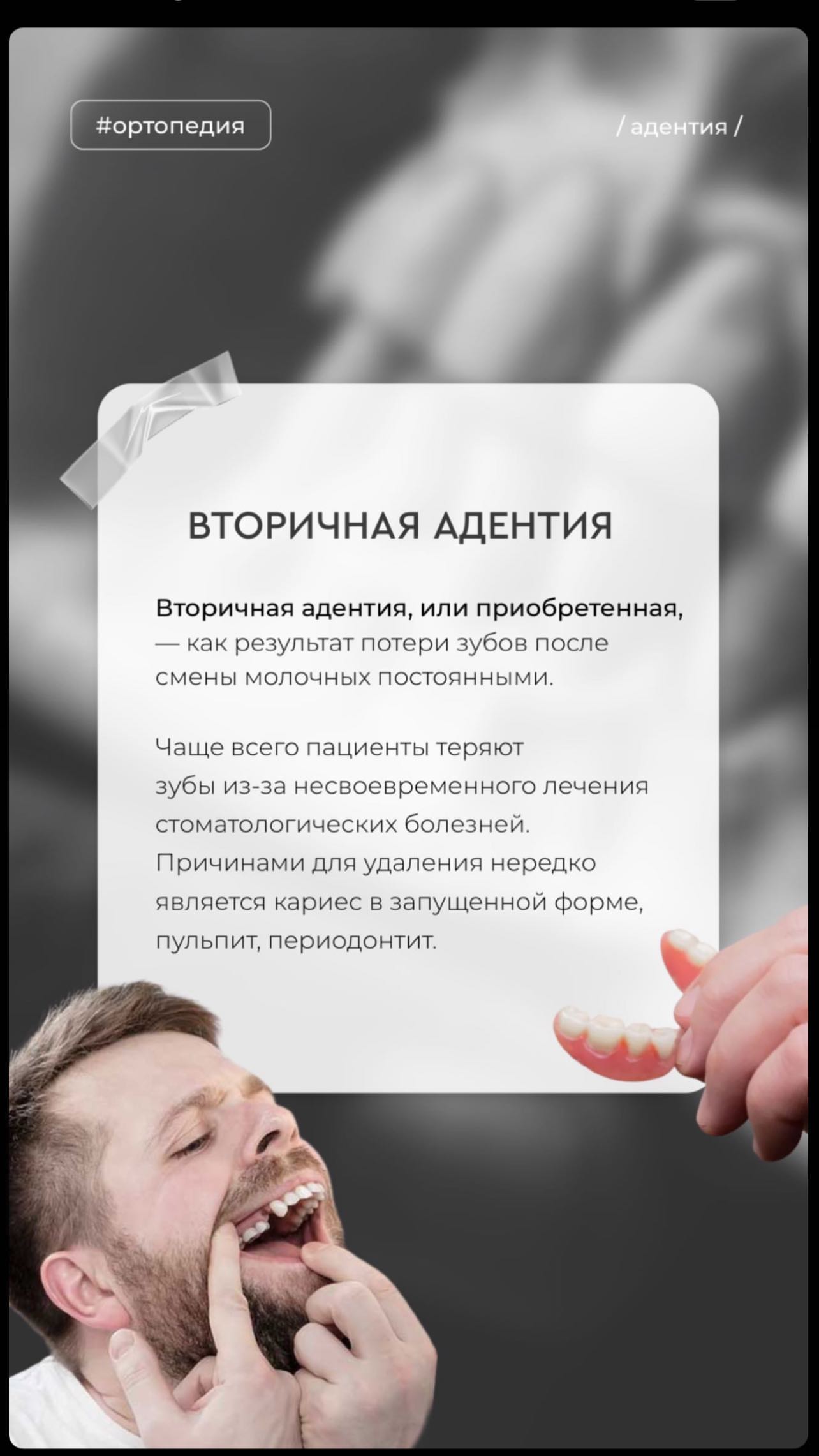 Керамика реставрация зубов