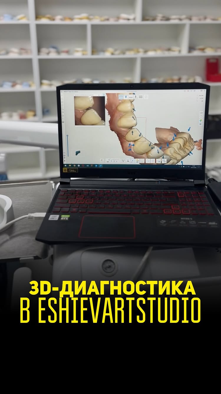 3D-диагностика